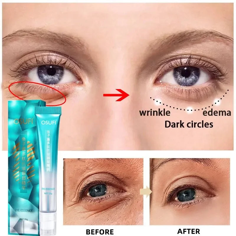 Eye Bag Cream ,Anti Wrinkle Remove