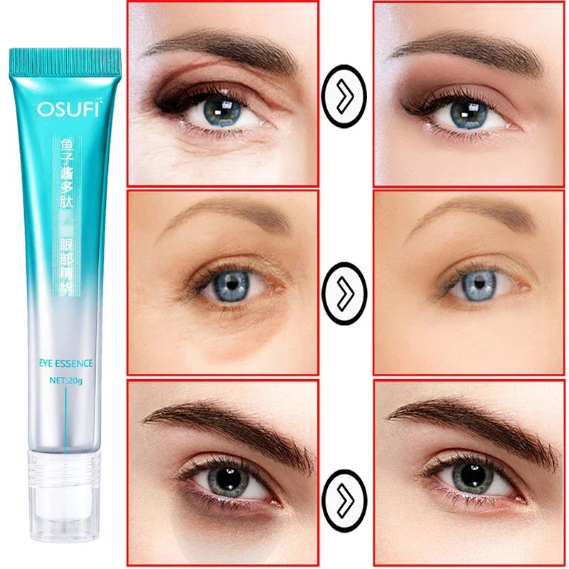 Eye Bag Cream ,Anti Wrinkle Remove