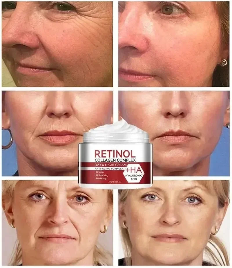 Retinol Wrinkle Removing Cream