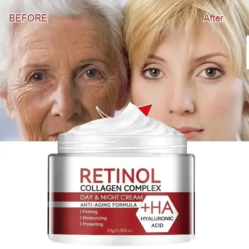 Retinol Wrinkle Removing Cream