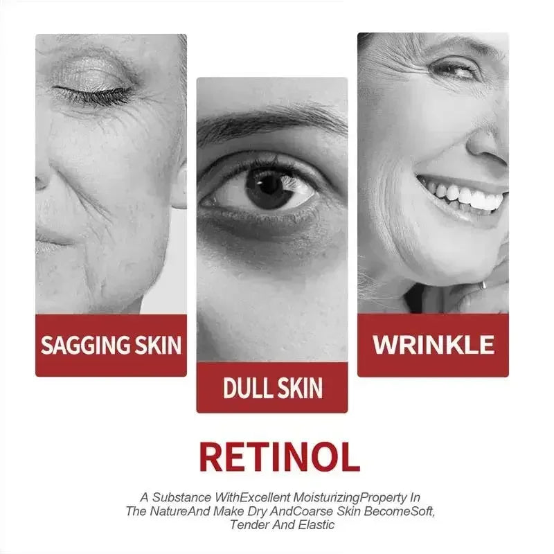 Retinol Wrinkle Removing Cream