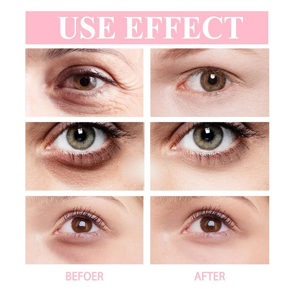 Eye Cream Wrinkle Removing, Dark Circles Lightening